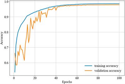 A robust multiple heartbeats classification with weight-based loss based on convolutional neural network and bidirectional long short-term memory